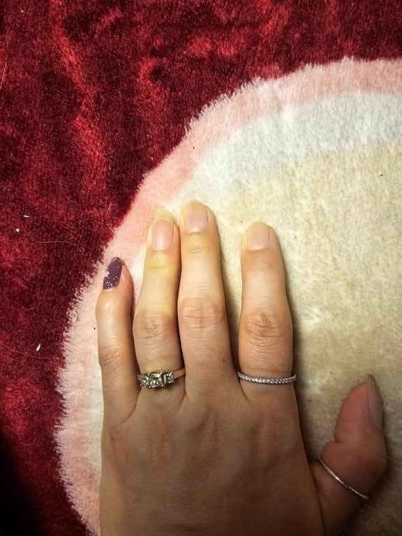 Oval diamond ring on hand
