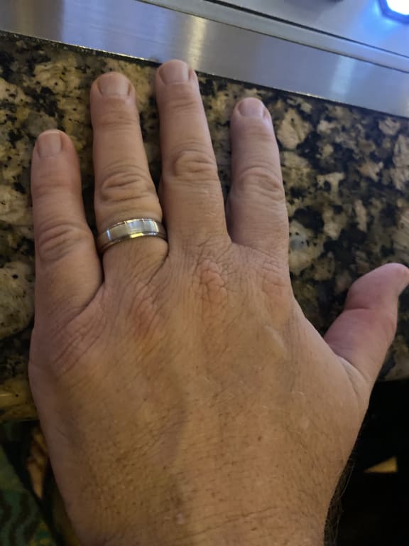 Oval diamond ring on hand